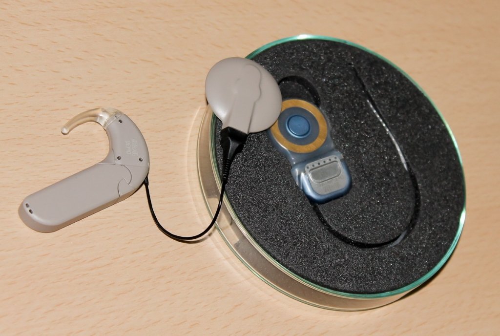  160258_106557_stiri_Implant-cohlear-3