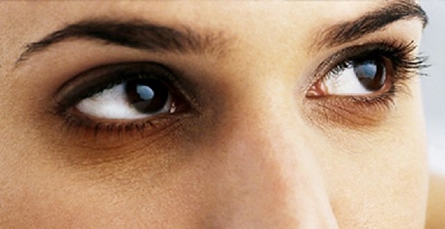  Cearcănele nu apar doar din lipsa somnului. Ce boli grave pot ascunde și când să mergi la medic