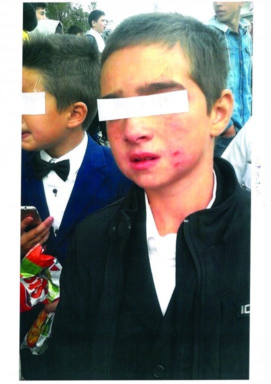  272899_178097_stiri_copil-batut2