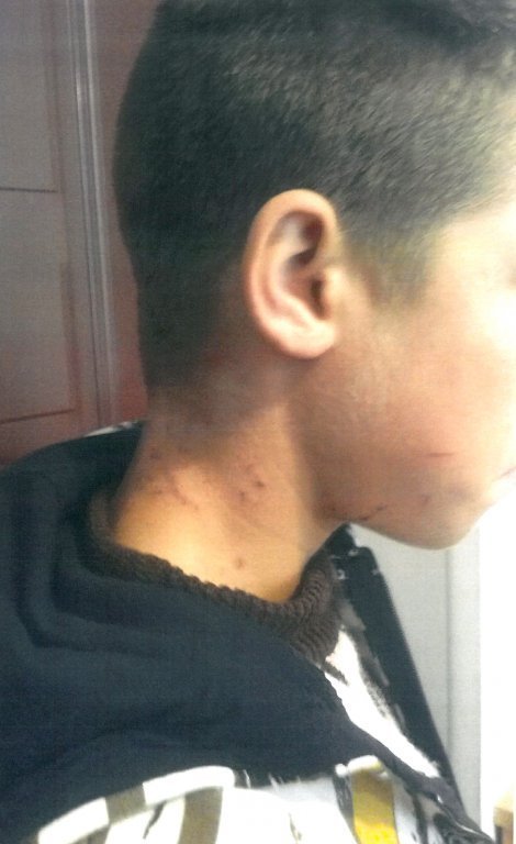  272900_178097_stiri_copil-batut