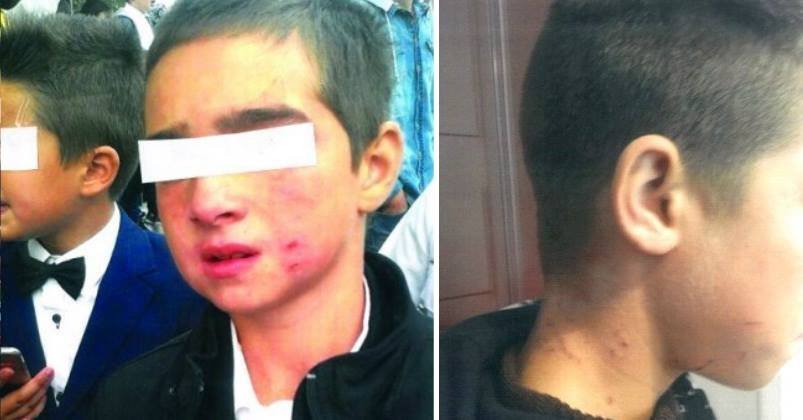  272970_178097_stiri_copil-batut