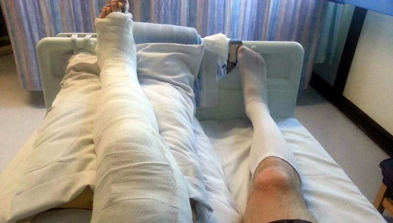 Două sisteme diferite – Un italian își rupe piciorul în SUA. Un american își rupe piciorul în Italia. Cine „câștigă”?