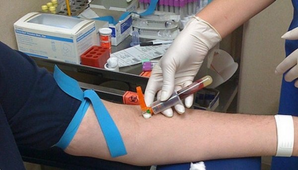  Un șofer bănuit că era băut și-a dat acordul să-i fie prelevat sânge, dar fără ac. Judecătorii au rezolvat dilema condamnându-l la un an de închisoare