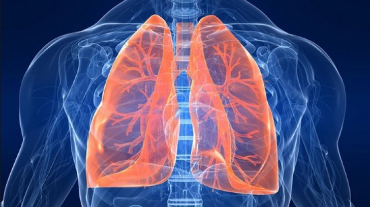 STUDIU | De ce revin uneori infecţiile pulmonare chiar şi după luni de tratament?