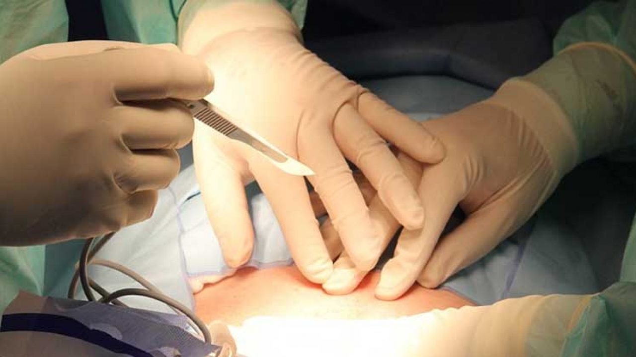 Medicii din Iași sunt șocați de cazul unei tinere de 22 de ani care a ajuns la a cincea cezariană. Ultima, la mai puțin de un an de la nașterea anterioară