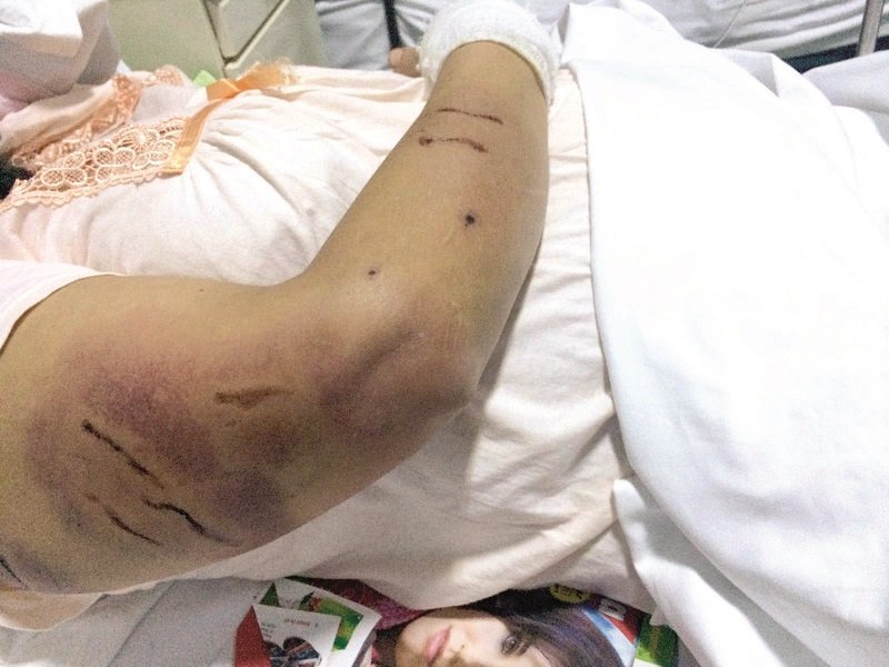  CAZ REVOLTĂTOR – Nenorocită de câini maidanezi, batjocorită de Salubris şi Primărie