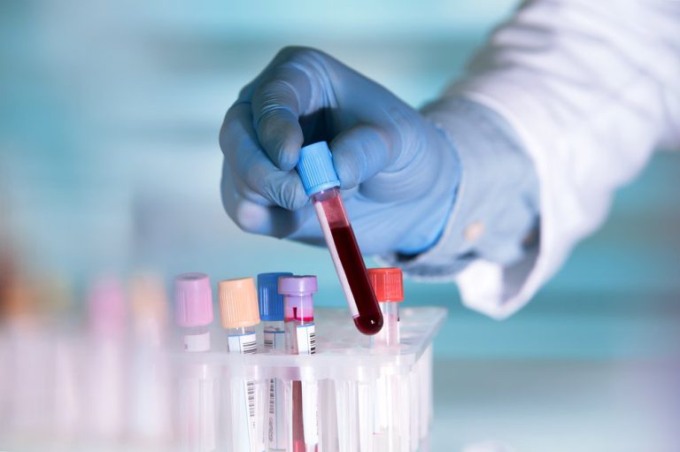 Ministerul Sănătăţii: Două cazuri de antrax confirmate în România – tată şi fiu care au mâncat carne de oaie din propria gospodărie