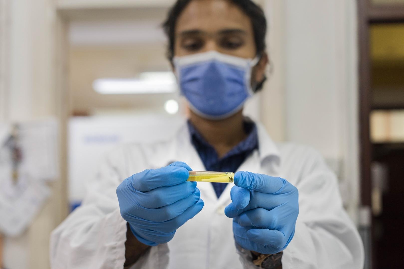  Rafila: Aproape 15.000 de cazuri de COVID-19 au fost înregistrate în ultima săptămână