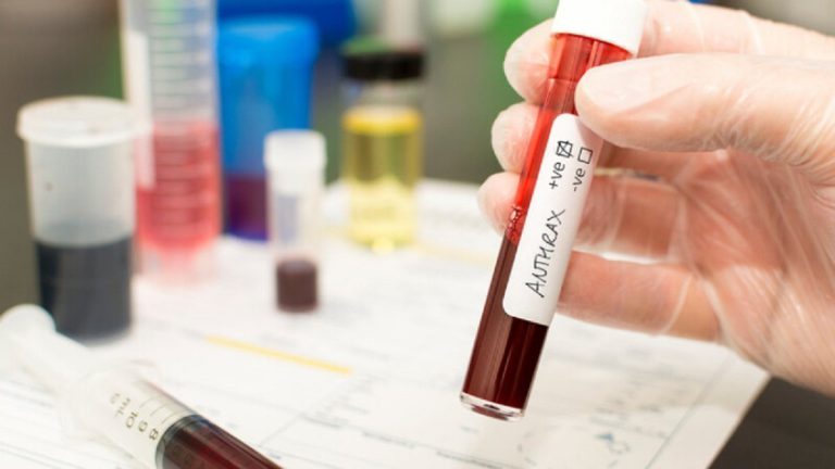 Suspiciune de antrax la două persoane internate la Institutul Naţional de Boli Infecţioase ”Matei Balş” din Bucureşti