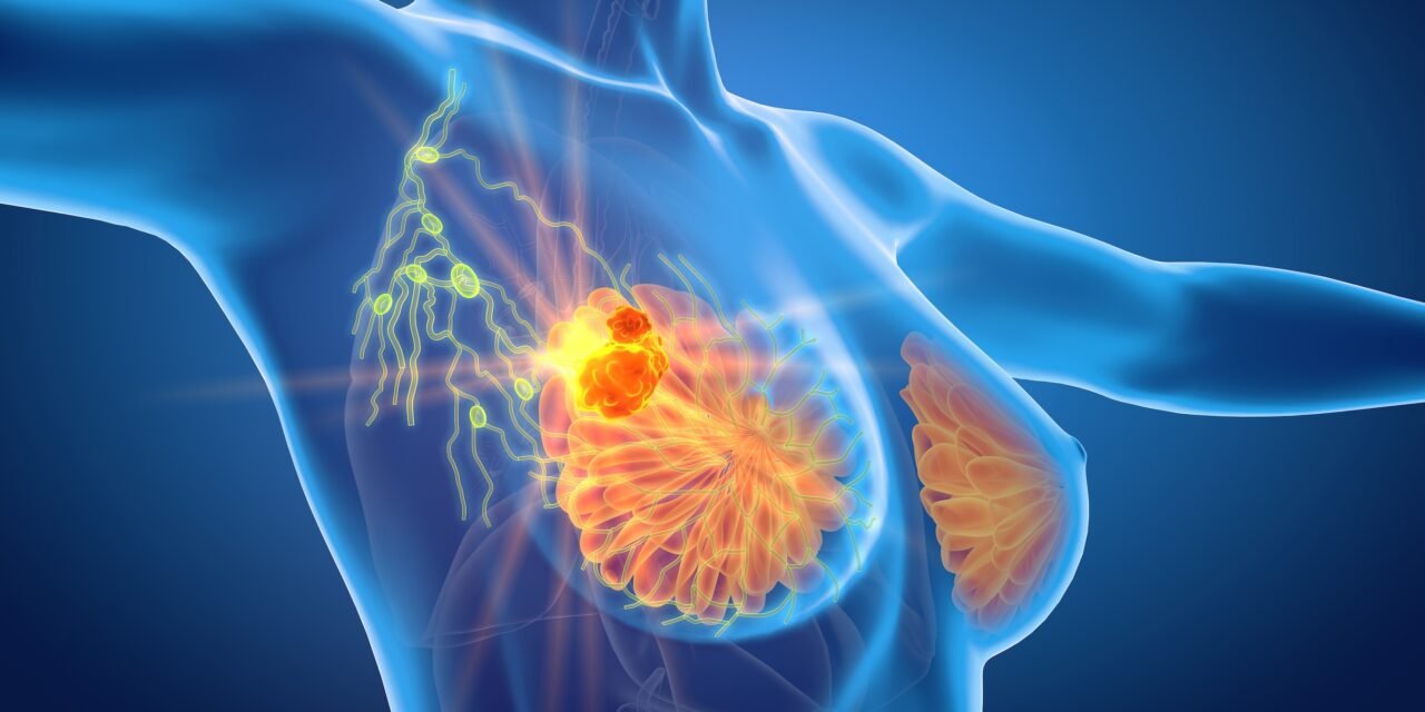 Cercetătorii au descoperit de ce cancerul de sân triplu negativ este atât de agresiv