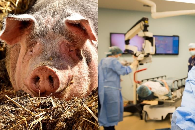 Premieră mondială în medicină: primul transplant de ficat de porc într-un organism uman. Un experiment care a ținut 10 zile