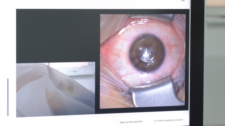 Cum scapi de ochelari cu o procedură nedureroasă, de câteva minute? Totul despre terapia laser