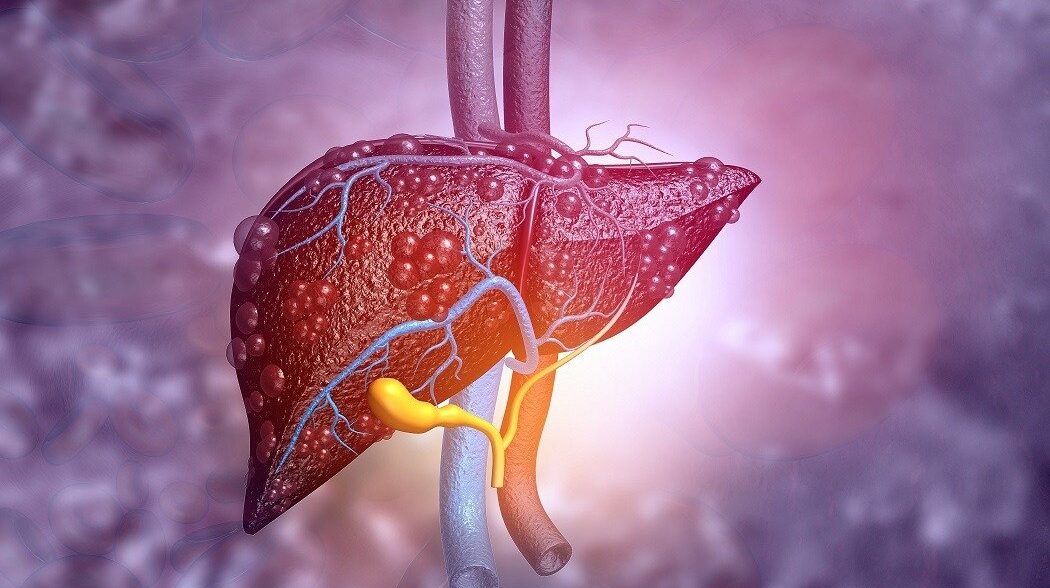 Modificări minore în alimentaţie ar putea preveni o boală comună a ficatului