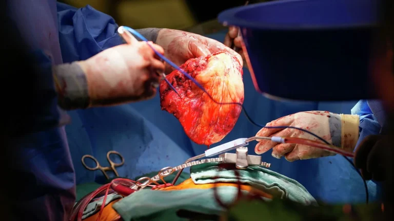 AI ar putea oferi în timp real informații vitale chirurgilor privind compatibilitatea  pentru un transplant cardiac