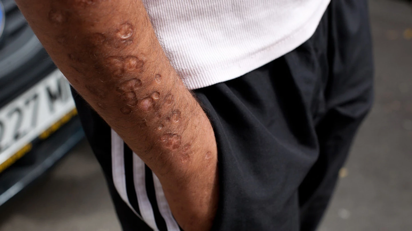 Bărbat din Iași abia eliberat din penitenciar prins cu heroină asupra lui