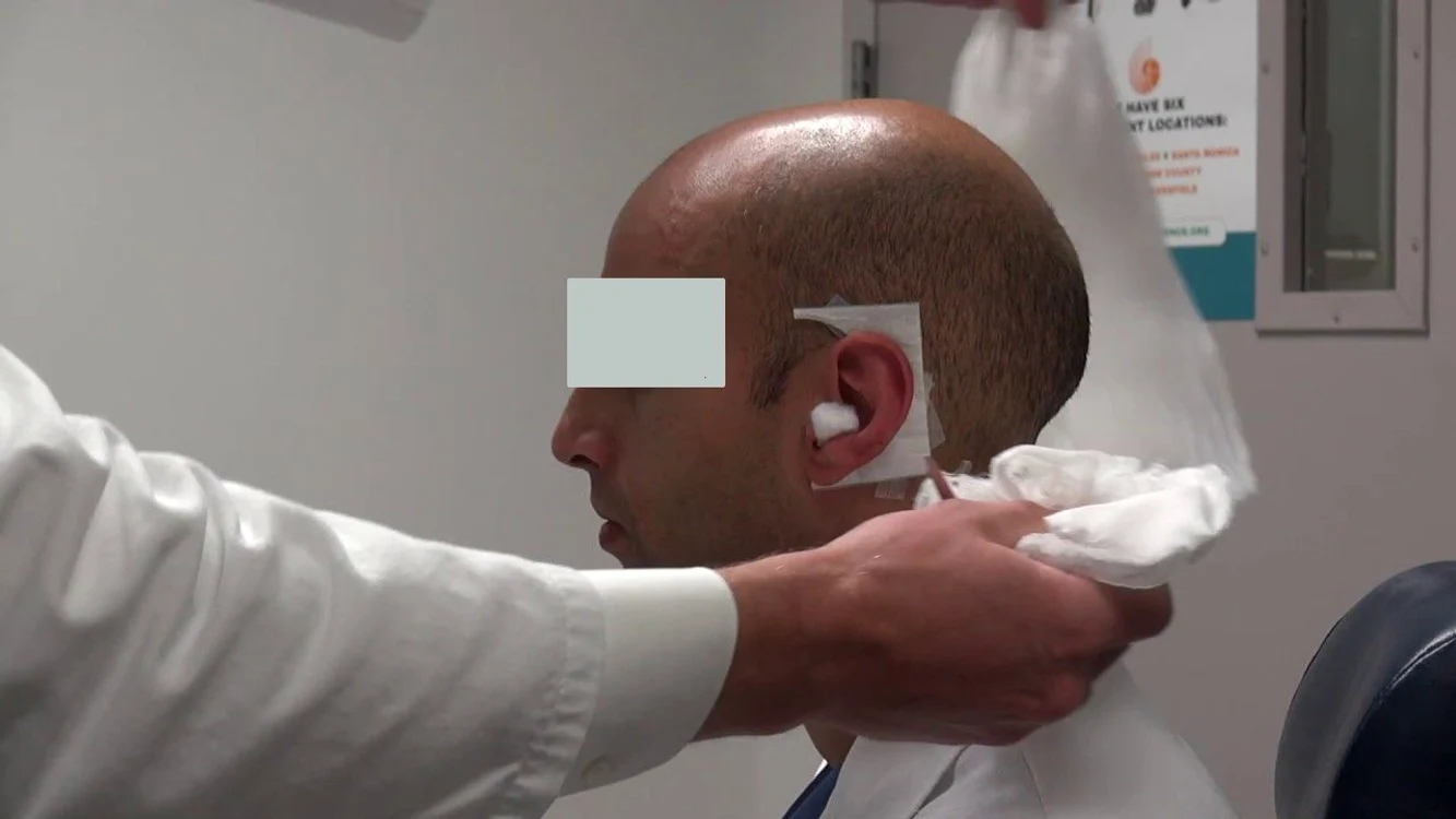 Cu urechea pusă în gheaţă, la spital la Iaşi. Amicul de pahar i-a muşcat-o, i-a rupt-o, apoi a mestecat-o