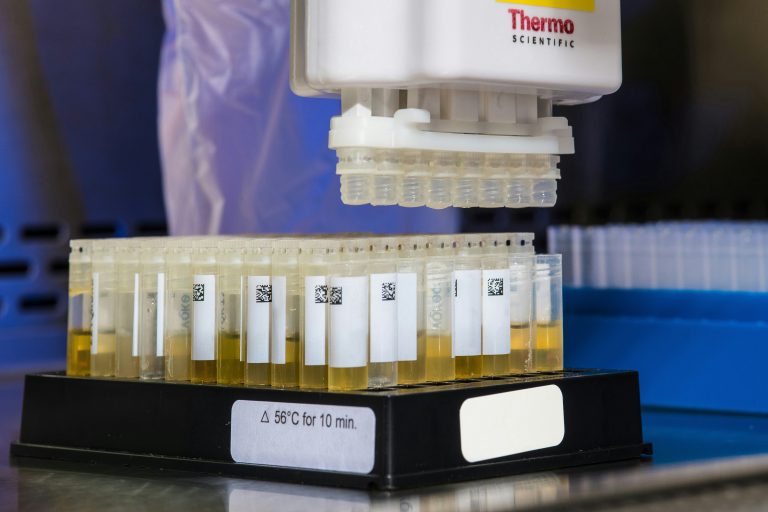 Un test de urină făcut acasă ar putea evidenția cancerele din sfera ORL