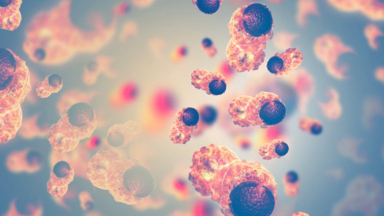 Cercetătorii au descoperit o legătură între dietă și apariția cancerului. Boala ar putea fi prevenită printr-un test simplu