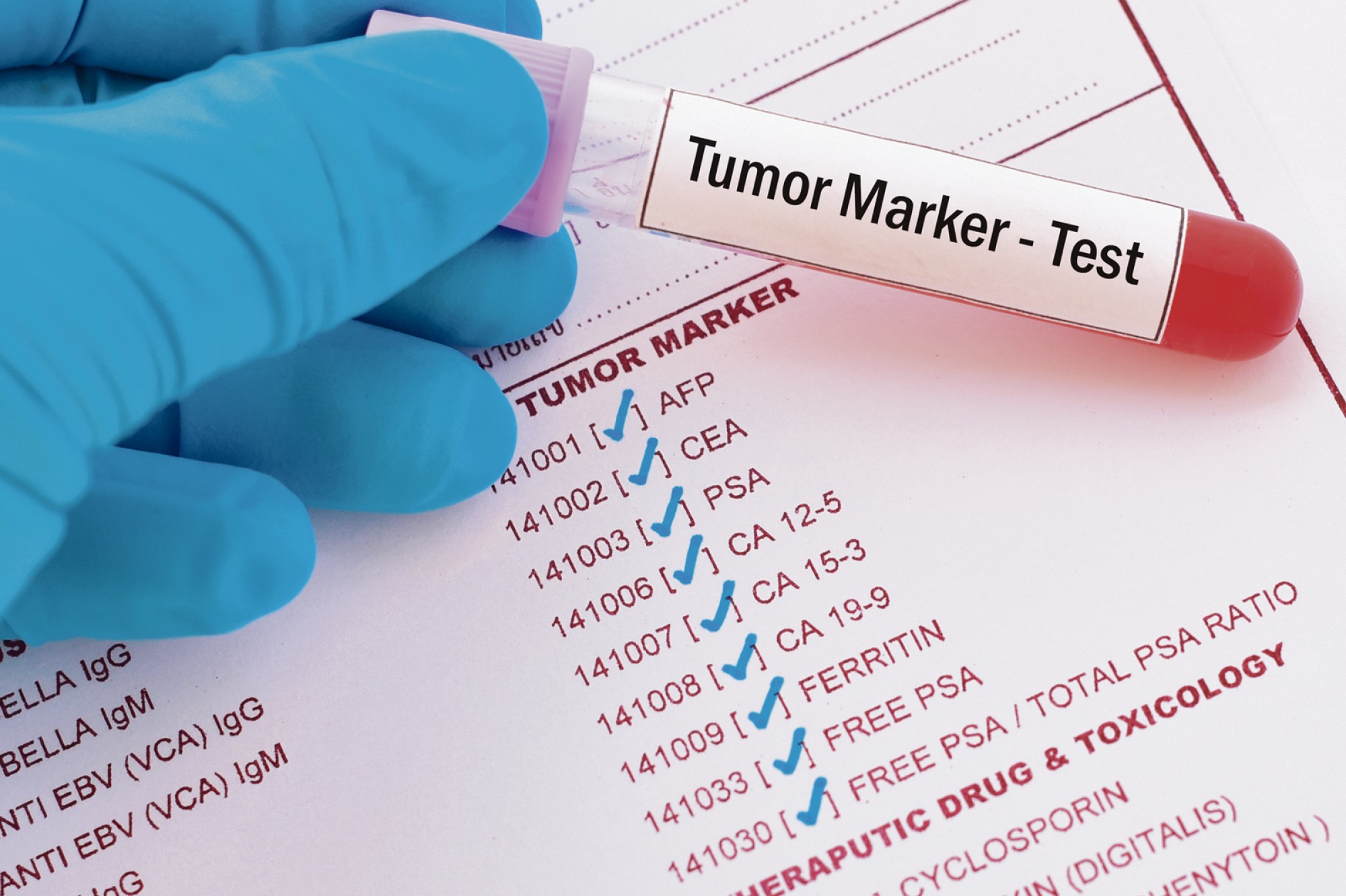 Persoanele neasigurate vor putea face analizele necesare depistării precoce a afecţiunilor oncologice