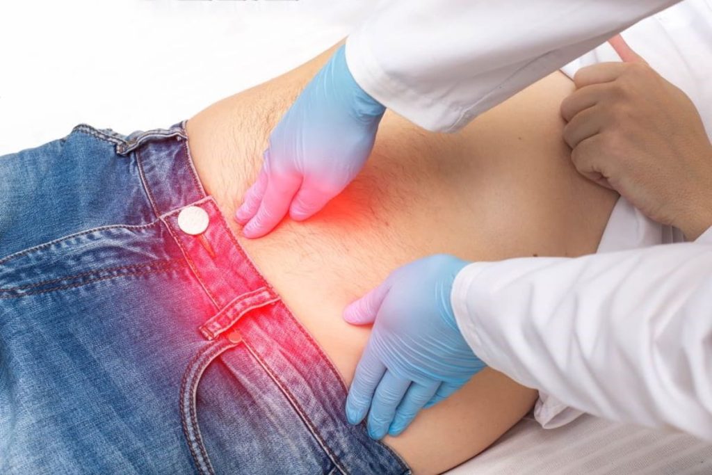  5 lucruri pe care trebuie să le știi despre hernia abdominală (P)
