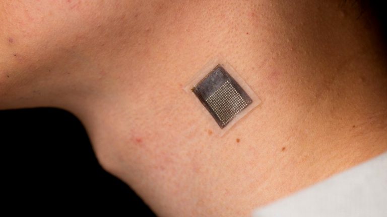A fost inventat plasturele inteligent care poate detecta precoce cancerul de piele