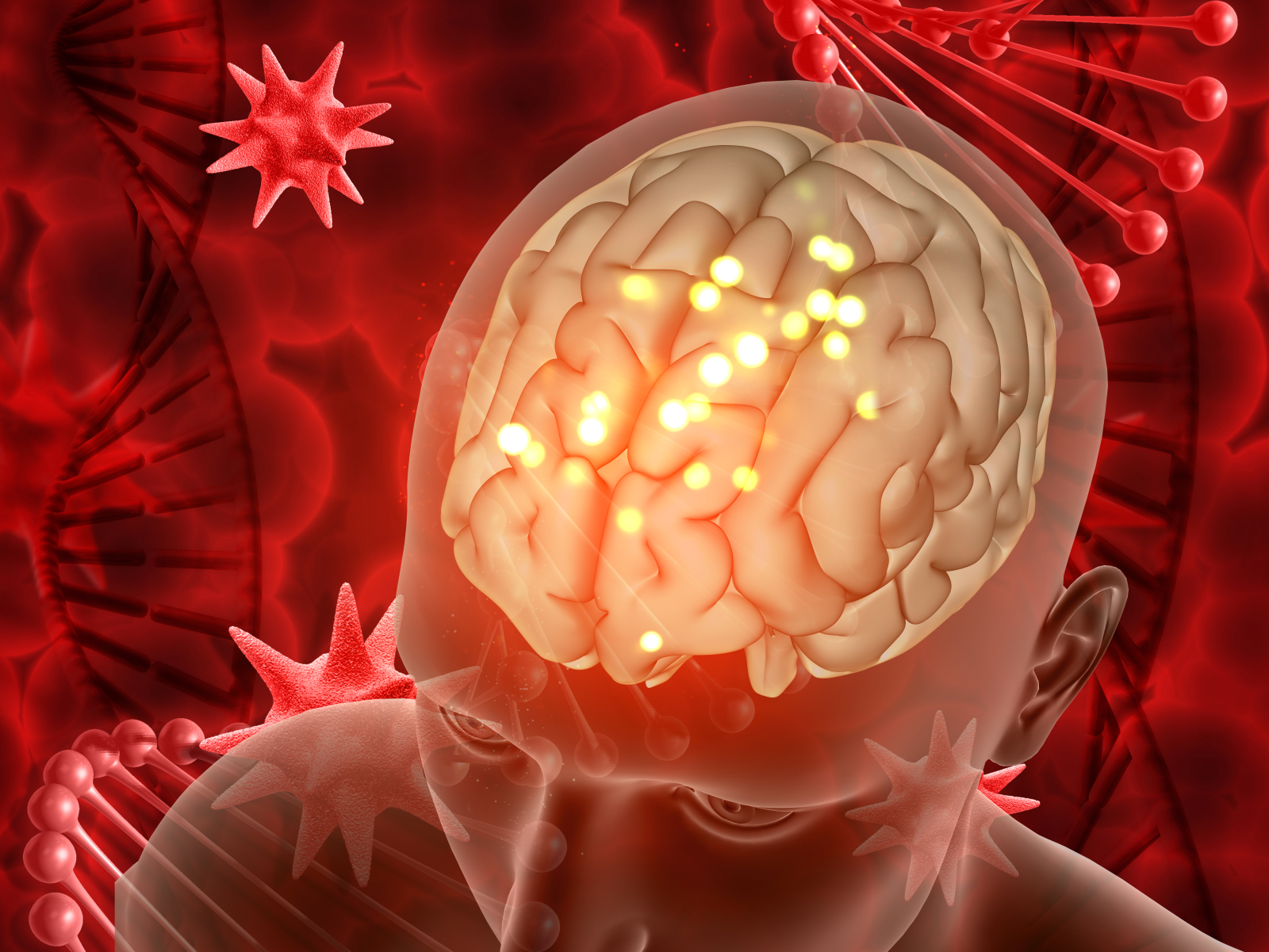 Posibilă legătură între sindroamele gastrointestinale și riscul de anevrism cerebral?