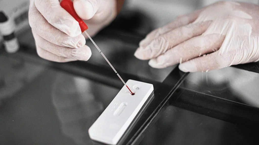O nouă descoperire sugerează că terapiile împotriva HIV ar putea preveni şi boala Alzheimer