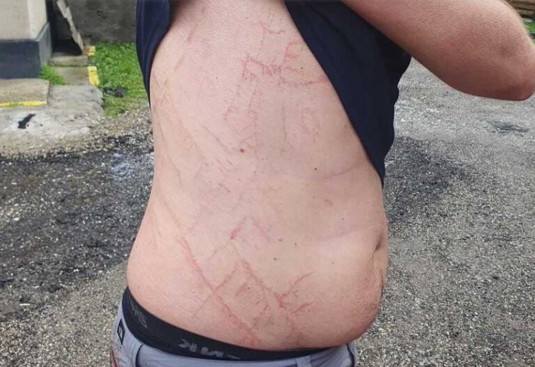 Ce pățești dacă un fulger lovește lângă tine. Imagini oferite de salvamontiști - FOTO