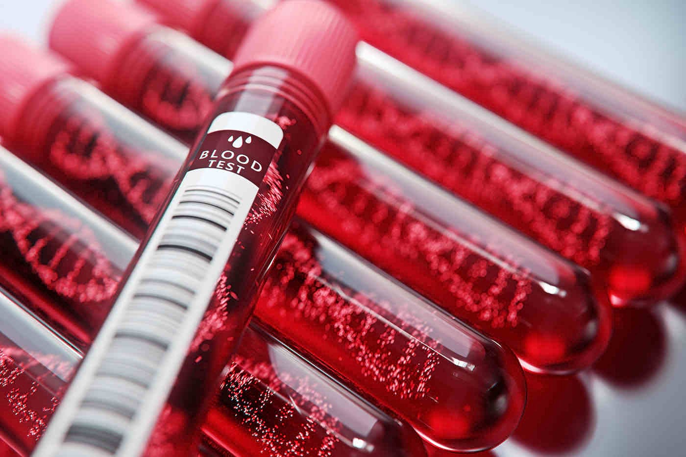 Testarea acizilor grași din sânge pot anunța apariția timpurie a diabetului infantil