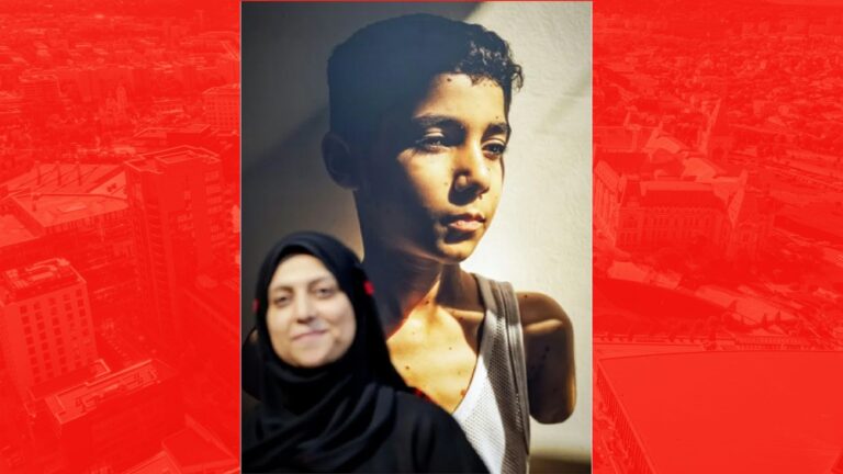 Portretul unui băiat palestinian cu mânile amputate câştigă World Press Photo 2025
