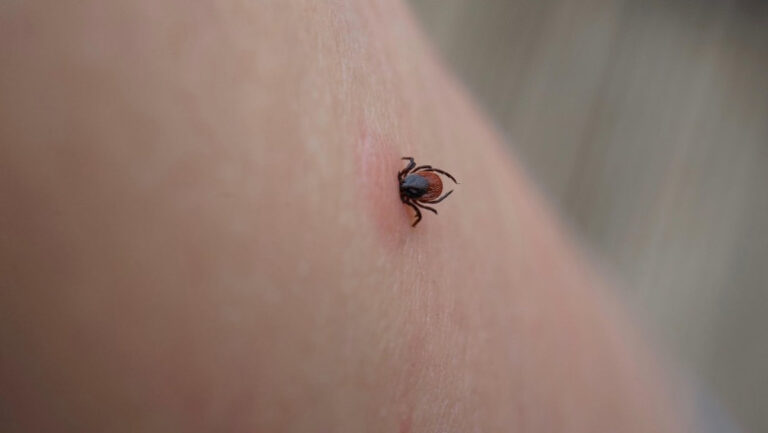 Pericolul Lyme, tot mai mare în codrii Iașului. Creștere îngrijorătoare a cazurilor de mușcături de căpușe în acest an: risc de boală pentru 30% din pacienți