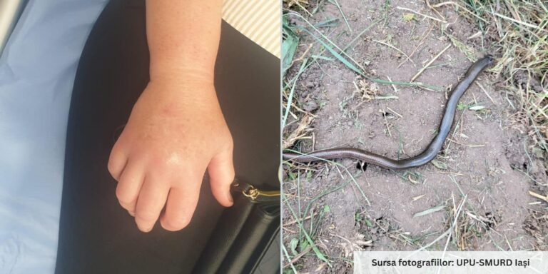 O femeie mușcată de viperă a fost adusă de medici la spital cu șarpele în borcan. A primit serul antivperin - UPDATE