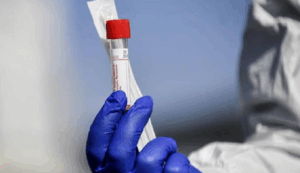Studiu revoluţionar la Stanford: un test de sânge poate estima vârsta biologică a organelor umane