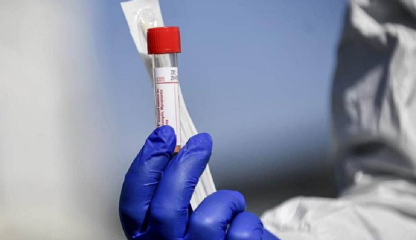  Studiu revoluţionar la Stanford: un test de sânge poate estima vârsta biologică a organelor umane