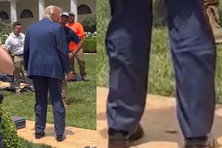 Donald Trump, diagnosticat cu o insuficienţă venoasă după o examinare a picioarelor