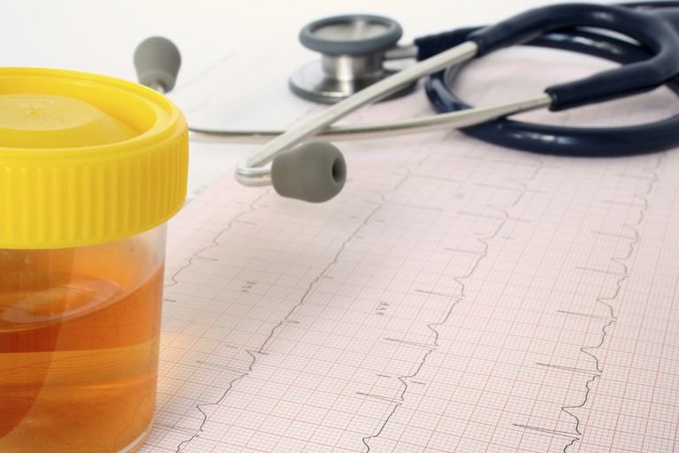 „Nu știam că la voi e interzis”. În loc să facă pipi în borcănelul de probe, a pus în el apă de la WC. Ce a pățit în instanță un șofer ieșean prins drogat la volan?